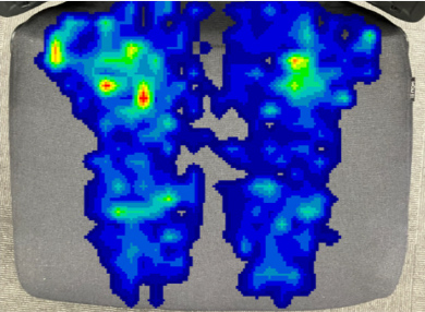 座面体圧分布図